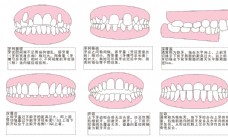 口腔牙齿畸形图图片